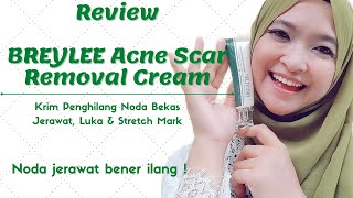 Breylee Acne scar removal gel reviewHow to use Breylee Acne scar removal gelskin care acne gel [upl. by Nepean]