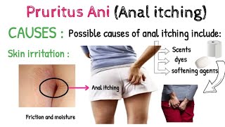 Anal itching Pruritus Ani  Symptoms  Causes  TESTS AND DIAGNOSIS  TREATMENTS AND DRUGS [upl. by Mohn]