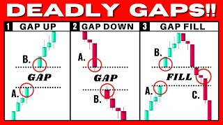 This Gap Trading Strategy Prints You Money Gap Up Gap Down Gap Fill [upl. by Amathist]