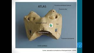 Osteologia Da Coluna Vertebral  Parte 01  Atlas Áxis e Vértebras Cervicais [upl. by Enialahs]