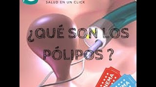 ¿Qué son los Pólipos [upl. by Hyacinthie]