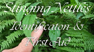 Stinging Nettles Identification and First Aid [upl. by Raynah]