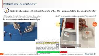 Conventional Transarterial Chemoembolization amp Drug Eluting Beds in Treating Hepatocellular CA [upl. by Bull586]