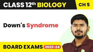 Downs Syndrome  Principles of Inheritance and Variation  Class 12 Biology 202223 [upl. by Lemraj]