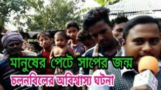 মানুষের পেটে সাপের জন্ম manuser pete saper jonmotop news [upl. by Miguelita]