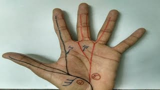 Median Nerve  3  Branches in Hand APB FPB OP Lumbricals 1 and 2 [upl. by Alveta161]