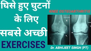 KNEE ARTHRITIS PAIN EXERCISES HINDI  KNEE PAIN EXERCISES HINDI  KNEE OSTEOARTHRITIS PAIN RELIEF [upl. by Ateiram]