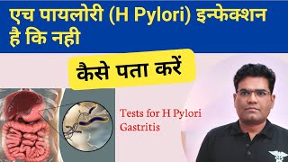 H Pylori Infection की जांच कैसे होती है  Tests for H Pylori Gastritis [upl. by Luz581]