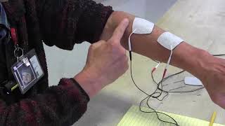 Stroke Rehabilitation Use of electrical stimulation to help arm and hand recovery [upl. by Eesak]