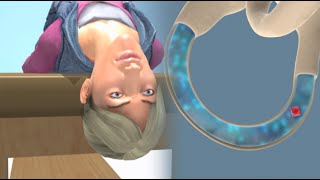 Deep Head Hanging Maneuver to Treat BPPV Vertigo [upl. by Felicio]