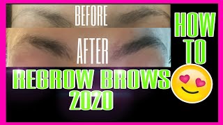 HOW TO GROW MY EYEBROWS BACK FAST  EYEBROW REGROWTH  RevitaBrow REVIEW Before After 2020 [upl. by Trefler]