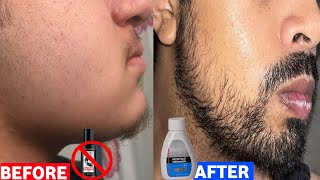 Beard growth  Minoxidil beard growth  mintop minoxidil 5 review  dr reddy minoxidil 5 beard [upl. by Nnelg814]