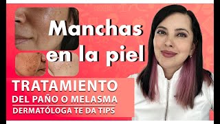 PAÑOMELASMA TRATAMIENTO y Tips de una Dermatóloga 👩🏻‍⚕️ [upl. by Beckett]