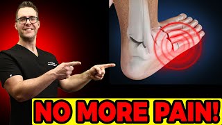 Hairline Stress Fracture in the Foot Symptoms amp Best TREATMENT [upl. by Jacki252]