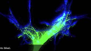 Nerve growth conessubtitles only [upl. by Amick]