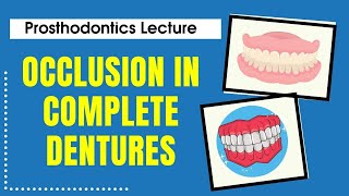 Occlusion in Complete Dentures  Prosthodontics Lecture  Dr Manase [upl. by Yevol139]