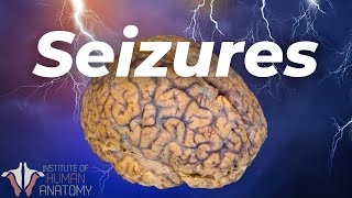 Whats Actually Happening During a Seizure [upl. by Arnaldo719]