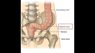 Anatomy of Sigmoid Colon [upl. by Kristen]