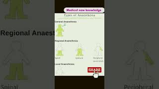 Types of anaesthesia medicostudent anaesthesia new viral shorts [upl. by Emmer]