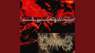 Cephalotripsy  Uterovaginal Insertion Of Extirpated Anomalies full album [upl. by Froemming]