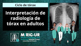 Interpretación de Radiografía de Tórax en Adultos  MIRIGUR [upl. by Harewood]