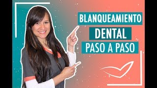 Blanqueamiento Dental Paso a Paso  Doctora Verónica [upl. by Aseneg]