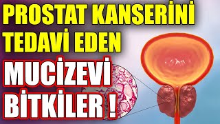 Prostat Kanseri Neden Olur Ve Tedavi Eden Mucize Bitki [upl. by Yeroc581]