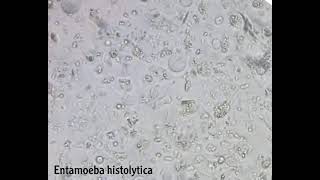 Entamoeba histolytica and trichomonas hominis [upl. by Lore]