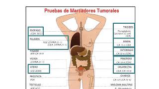 Marcadores Tumorales [upl. by Auoh]