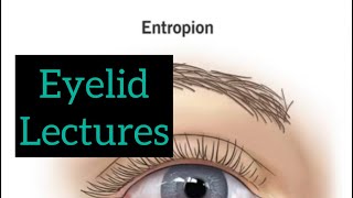 Eyelid lectures part 6 Eye lectures  Opthalmology eyelectures eyelid jatoi eyelid [upl. by Akimahc931]