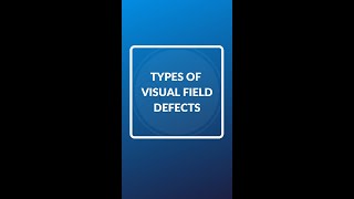 Types of visual field defects shorts optometry optomyze [upl. by Neladgam649]