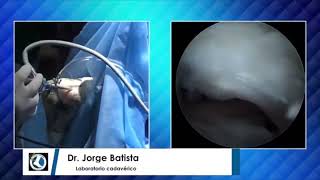 Curso Dr Jorge Batista 2019 ATC posterior de tobillo en tiempo real 38 min de duración [upl. by Hayott]