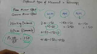 Different types of movement in Retinoscopy [upl. by Juno415]