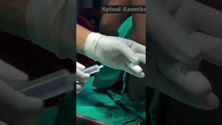 Spinal anaesthesia proceduresdoctornursingmotivationshortvideoviralvideo [upl. by Pool]