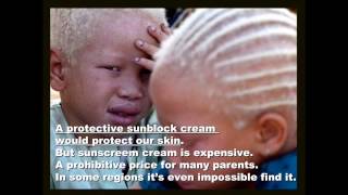 Albinism in Africa [upl. by Nila345]