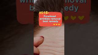 Forehead wrinkles removal best remedy shorts wrinkles healthytips viral [upl. by Islek]