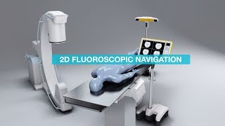 Brainlab Fluoro 2D Registration and Navigation [upl. by Annavaj]