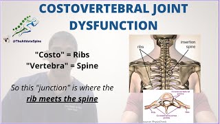 What is Costovertebral Joint Dysfunction A look into Mike Trouts Rare Back Injury [upl. by Annas]