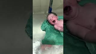 What a Active Lungs of New Born BAby Cry HardVernix Remove Start [upl. by Igic]