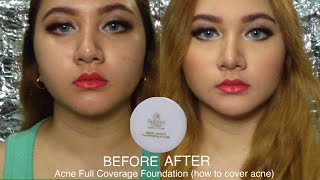 Sariayu Bedak Jerawat Review dan Demo Acne Full Coverage Foundation  DienDiana [upl. by Nabalas571]