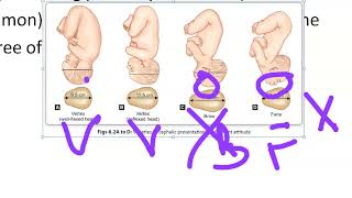 Obsetrics 110 Fetal Presentation Presenting part position difference importance what is [upl. by Ekal]