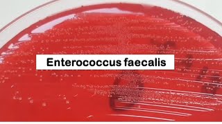 Enterococcus faecalis Colony Morphology on CLED Agar [upl. by Aerdnua406]