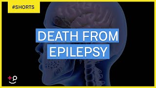 Can You Die From Epilepsy Shorts [upl. by Felder]