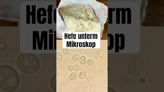 So sieht Hefe unterm Mikroskop aus wissenswert biologie natur mikrokosmos mikroskop fyp [upl. by Lednyk]