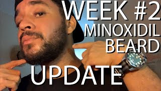 My Minoxidil Beard Update  WEEK 2 New growth [upl. by Artemas]