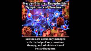 Herpes Simplex Encephalitis Symptoms and Treatment [upl. by Hillell]