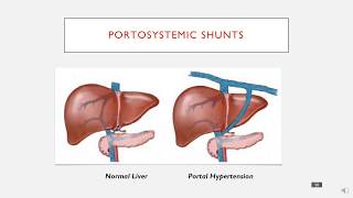 Portosystemic Shunts in 3 minutes [upl. by Jaan]