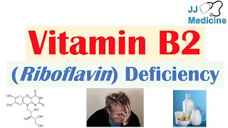 Vitamin B2 Riboflavin Deficiency  Food Sources Causes Symptoms Diagnosis and Treatment [upl. by Hutchison]