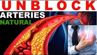 Reversing Atherosclerosis Naturally Herbal Cure How To Reverse Reduce Plaque Buildup In Arteries [upl. by Coltin]