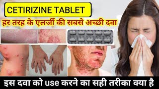 cetirizine hydrochloride tablets ip 10mg in hindi  Cetirizine tablets uses  Allergy Treatment [upl. by Akcir]